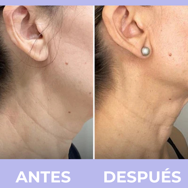 PURA Skincare™  Crema para el Cuello