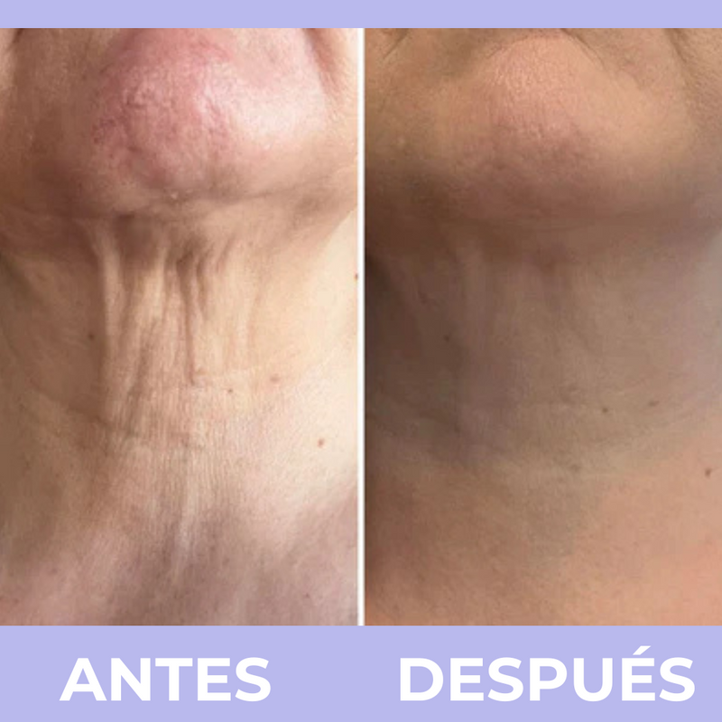 PURA Skincare™  Crema para el Cuello