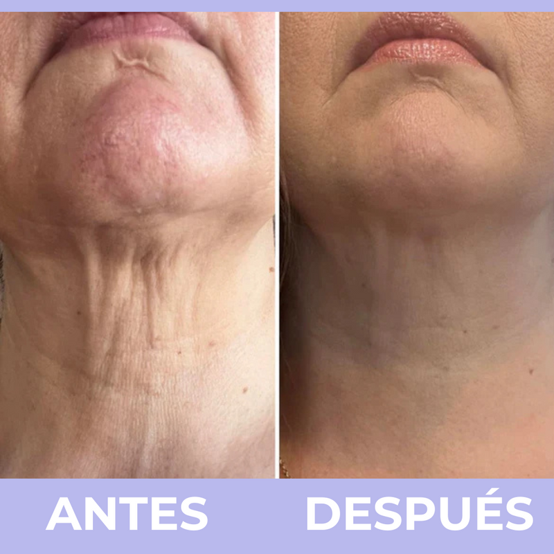 PURA Skincare™  Crema para el Cuello
