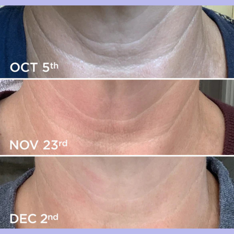PURA Skincare™  Crema para el Cuello